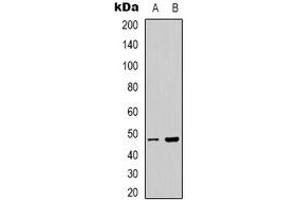 Western blot analysis of PSKH1 expression in Hela (A), HepG2 (B) whole cell lysates. (PSKH1 antibody)