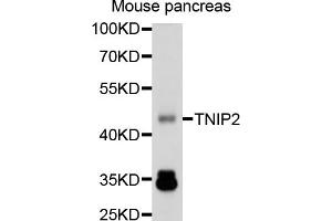 Western blot analysis of extracts of mouse pancreas, using TNIP2 antibody (ABIN1875145) at 1:1000 dilution. (TNIP2 antibody)