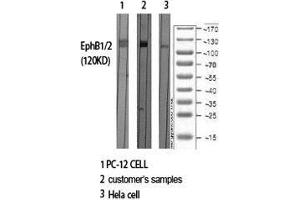 Western Blot (WB) analysis of specific cells using EphB1/2 Polyclonal Antibody. (EPHB1/2 antibody  (Ser10))