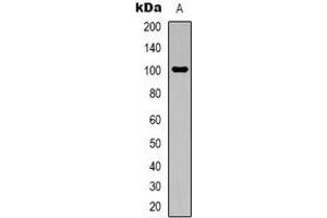 Western blot analysis of Aconitase 1 expression in Hela (A) whole cell lysates. (Aconitase 1 antibody  (N-Term))