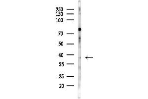 anti-Coproporphyrinogen Oxidase (CPOX) (N-Term) antibody