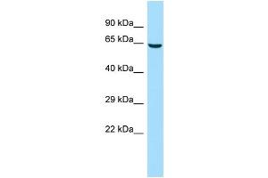 Host: Rabbit Target Name: CDADC1 Sample Type: 293T Whole Cell lysates Antibody Dilution: 1.