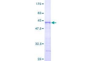 HIV-1 Tat Interactive Protein 2, 30kDa (HTATIP2) (AA 1-242) protein (GST tag)