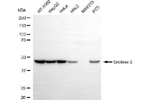 Western blotting analysis using enolase 2 antibody (ABIN7798450).