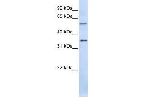 WB Suggested Anti-TJAP1 Antibody Titration:  0. (TJAP1 antibody  (C-Term))