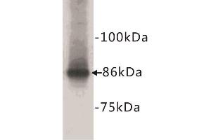 Western Blotting (WB) image for anti-Catenin, beta (CATNB) (N-Term) antibody (ABIN1854847) (beta Catenin antibody  (N-Term))