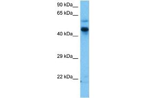 Host:  Mouse  Target Name:  ZIC3  Sample Tissue:  Mouse Brain  Antibody Dilution:  1ug/ml (ZIC3 antibody  (N-Term))