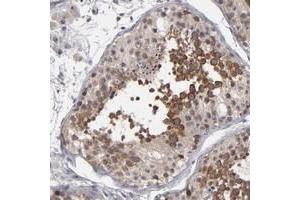 Immunohistochemical staining of human testis with GLCCI1 polyclonal antibody  shows distinct cytoplasmic positivity in primary spermatocytes in seminiferus ducts at 1:50-1:200 dilution. (GLCCI1 antibody)