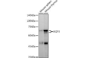 Western blot analysis of extracts of various cell lines, using IKZF3 antibody (ABIN7267842) at 1:500 dilution.