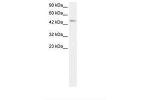 Image no. 1 for anti-Chemokine (C-C Motif) Receptor 8 (CCR8) (AA 163-212) antibody (ABIN202331) (CCR8 antibody  (AA 163-212))