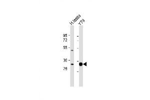 Western Blot at 1:1000 dilution Lane 1: human testis lysate Lane 2: Y79 whole cell lysate Lysates/proteins at 20 ug per lane. (ELOVL4 antibody  (C-Term))