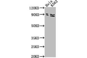 Western Blot Positive WB detected in: Hela whole cell lysate, K562 whole cell lysate All lanes: SUPV3L1 antibody at 1:2000 Secondary Goat polyclonal to rabbit IgG at 1/50000 dilution Predicted band size: 88 kDa Observed band size: 88 kDa (SUPV3L1 antibody  (AA 499-786))