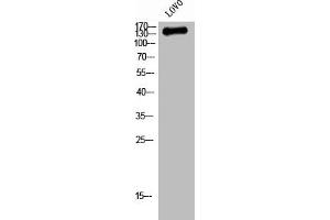 Western Blot analysis of LOVO cells using QSK Polyclonal Antibody (SIK3 antibody  (Internal Region))