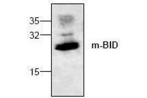 Image no. 1 for anti-BH3 Interacting Domain Death Agonist (BID) antibody (ABIN127071) (BID antibody)