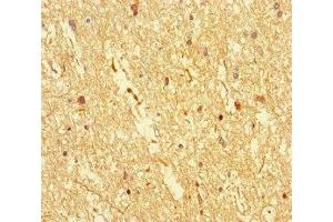 Immunohistochemistry of paraffin-embedded human brain tissue using ABIN7149587 at dilution of 1:100 (DOCK3 antibody  (AA 1630-1934))