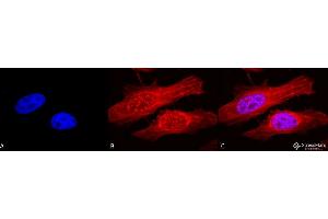 Immunocytochemistry/Immunofluorescence analysis using Rabbit Anti-Alpha B Crystallin Polyclonal Antibody . (CRYAB antibody  (Biotin))