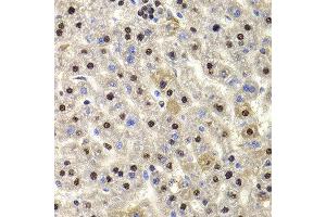 Immunohistochemistry of paraffin-embedded rat liver using HIRIP3 antibody at dilution of 1:100 (x400 lens).