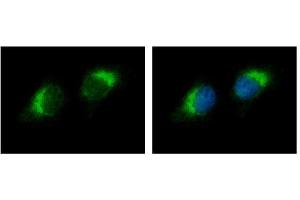 ICC/IF Image Ribonuclease A antibody detects RNASE1 protein at cytoplasm by immunofluorescent analysis. (RNASE1 antibody  (Center))