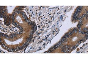 anti-Integrin, alpha E (Antigen CD103, Human Mucosal Lymphocyte Antigen 1, alpha Polypeptide) (ITGAE) antibody
