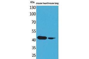 Western Blotting (WB) image for anti-Actin, Alpha, Cardiac Muscle 1 (ACTC1) (N-Term) antibody (ABIN3180981) (ACTC1 antibody  (N-Term))