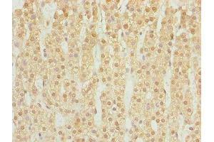 Immunohistochemistry (IHC) image for anti-Dehydrogenase/reductase (SDR Family) Member 3 (DHRS3) (AA 30-169) antibody (ABIN7169532)