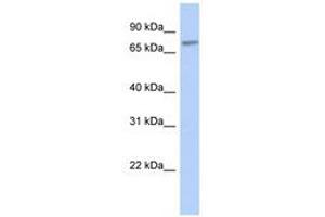 ZNF45 antibody  (C-Term)