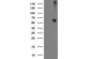 HEK293T cells were transfected with the pCMV6-ENTRY control (Left lane) or pCMV6-ENTRY ADH1B (Right lane) cDNA for 48 hrs and lysed. (ADH1B antibody)