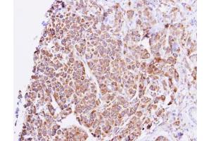 IHC-P Image GNAL antibody detects GNAL protein at cytosol on NCI-N87 xenograft by immunohistochemical analysis. (GNAL antibody  (Center))