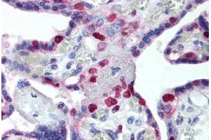Human Placenta (formalin-fixed, paraffin-embedded) stained with PCNA antibody ABIN239835 at 10 ug/ml followed by biotinylated anti-mouse IgG secondary antibody ABIN481714, alkaline phosphatase-streptavidin and chromogen. (PCNA antibody)