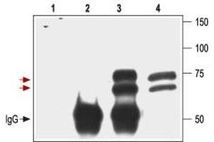 Immunoprecipitation (IP) image for anti-Nerve Growth Factor Receptor (NGFR) (AA 188-203), (Extracellular) antibody (ABIN7043344)