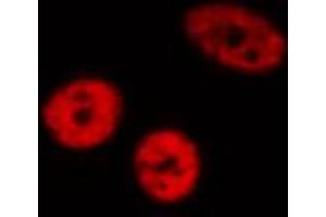 ABIN6272437 staining HeLa by IF/ICC. (ZNF280A antibody  (C-Term))
