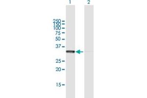 Western Blot analysis of RPLP0 expression in transfected 293T cell line by RPLP0 MaxPab polyclonal antibody. (RPLP0 antibody  (AA 1-317))