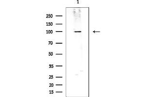 Western blot analysis of lysates from colo236(heat-shock treatment), using CNKR2 Antibody at 1/1000 dilution.
