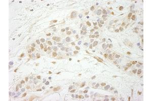 Immunohistochemistry (IHC) image for anti-Metastasis Associated 1 Family, Member 3 (MTA3) (AA 400-450) antibody (ABIN7448677) (MTA3 antibody  (AA 400-450))
