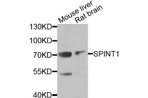 Western blot analysis of extracts of various cell lines, using SPINT1 antibody (ABIN5973812) at 1/1000 dilution. (SPINT1 antibody)