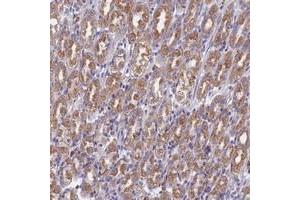 Immunohistochemical staining of human stomach with DDX51 polyclonal antibody  shows moderate cytoplasmic positivity in tubular cells at 1:50-1:200 dilution.