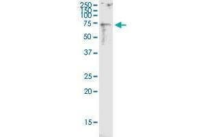 TNFRSF11A monoclonal antibody (M39), clone 2G2.