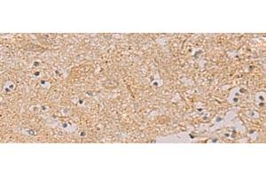 Immunohistochemistry of paraffin-embedded Human brain tissue using PTPRN Polyclonal Antibody at dilution of 1:55(x200) (PTPRN antibody)