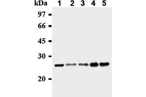 Western Blotting (WB) image for anti-MAD2 Mitotic Arrest Deficient-Like 1 (Yeast) (MAD2L1) antibody (ABIN567786) (MAD2L1 antibody)