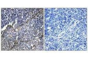 Immunohistochemistry analysis of paraffin-embedded human thymus gland tissue using Collagen XIX α1 antibody. (COL19A1 antibody)