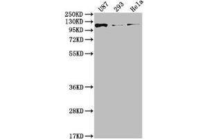 Western Blot Positive WB detected in: U87 whole cell lysate, 293 whole cell lysate, Hela whole cell lysate All lanes: FGFR3 antibody at 1:2000 Secondary Goat polyclonal to rabbit IgG at 1/50000 dilution Predicted band size: 88, 89, 76, 86 kDa Observed band size: 115 kDa (Recombinant FGFR3 antibody)