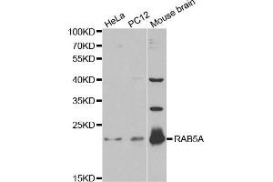 Western blot analysis of extracts of various cell lines, using RAB5A antibody (ABIN5970526) at 1/1000 dilution. (RAB5 antibody)