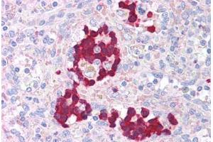 Human Spleen (formalin-fixed, paraffin-embedded) stained with AURKB antibody ABIN214031 at 5 ug/ml followed by biotinylated goat anti-rabbit IgG secondary antibody ABIN481713, alkaline phosphatase-streptavidin and chromogen. (Aurora Kinase B antibody  (AA 227-238))