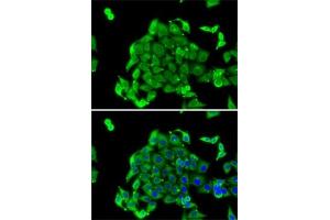 Immunofluorescence analysis of MCF7 cells using RPS14 antibody (ABIN6129109, ABIN6147198, ABIN6147199 and ABIN6222448). (RPS14 antibody  (AA 1-151))