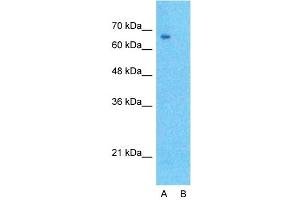 Host:  Rabbit  Target Name:  DLL1  Sample Type:  Hela  Lane A:  Primary Antibody  Lane B:  Primary Antibody + Blocking Peptide  Primary Antibody Concentration:  1ug/ml  Peptide Concentration:  5ug/ml  Lysate Quantity:  25ug/lane/lane  Gel Concentration:  0. (DLL1 antibody  (N-Term))