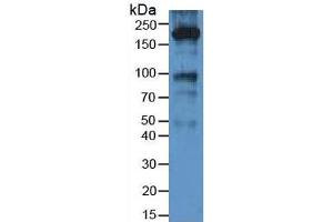 Rabbit Detection antibody from the kit in WB with Positive Control: Human lung tissue. (alpha 2 Macroglobulin CLIA Kit)