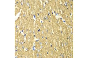 Immunohistochemistry of paraffin-embedded mouse heart using TPM3 antibody at dilution of 1:100 (400x lens). (TPM3 antibody)