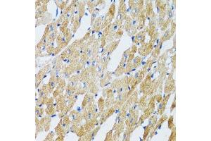 Immunohistochemistry of paraffin-embedded mouse heart using GABARAP antibody. (GABARAP antibody  (AA 1-100))