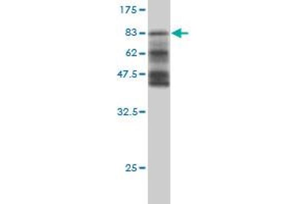 HERPUD1 Antikörper  (AA 1-391)