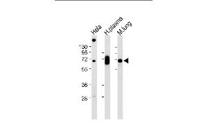 All lanes : Anti-LGALS3BP Antibody (Center) at 1:2000 dilution Lane 1: Hela whole cell lysate Lane 2: Human plasma lysate Lane 3: Mouse lung lysate Lysates/proteins at 20 μg per lane. (LGALS3BP antibody  (AA 383-412))